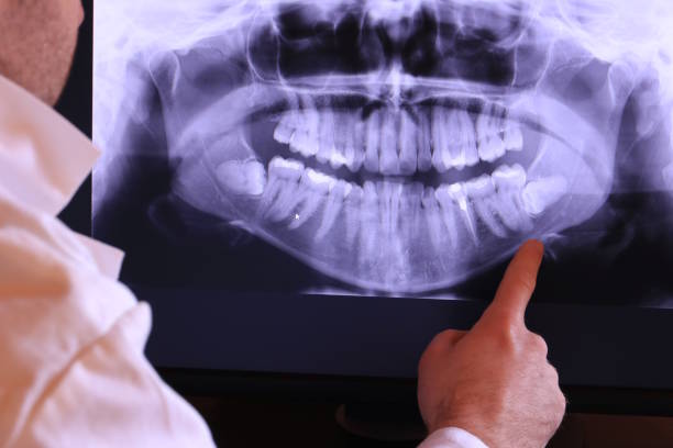 Best Emergency Treatment for Oral Infections in Whittier, CA