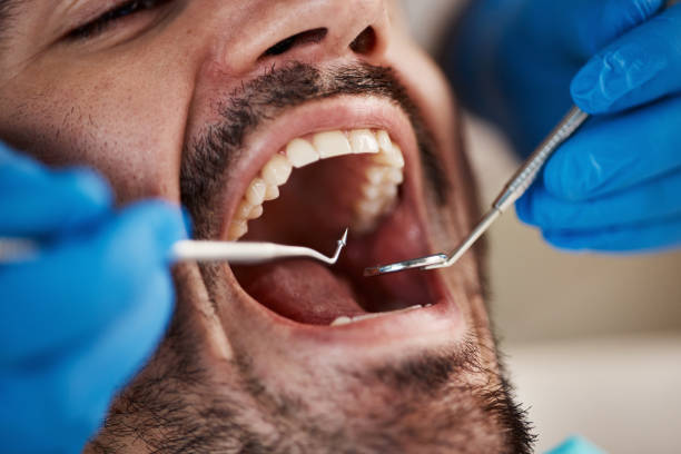 Best Emergency Treatment for Jaw Pain or Injury in Whittier, CA